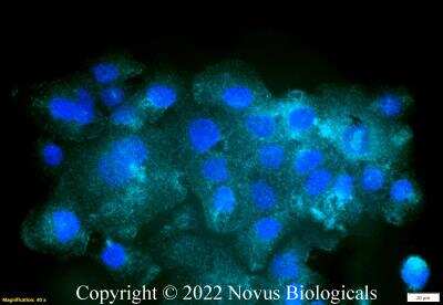 Immunocytochemistry/Immunofluorescence: CD68/SR-D1 Antibody (KP1) [Alexa Fluor® 647] [NB100-683AF647] - A431 cells were fixed in 4% paraformaldehyde for 10 minutes and permeabilized in 0.05% Triton X-100 in PBS for 5 minutes. The cells were incubated with CD68/SR-D1 Antibody [KP1] conjugated to Alexa Fluor 647 (NB100-683AF647) at 5 ug/ml for 1 hour at room temperature. Nuclei were counterstained with DAPI (Blue). Cells were imaged using a 40X objective.