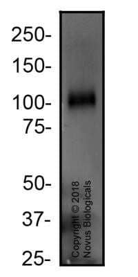 Western Blot: CD68/SR-D1 Antibody (KP1) - Purified [NBP2-79945] - Total protein from human spleen was separated on a 7.5% gel by SDS-PAGE, transferred to PVDF membrane and blocked in 5% non-fat milk in TBST. The membrane was probed with 1:50 anti-CD68 in 5% non-fat milk in TBST and detected with an anti-mouse HRP secondary antibody using chemiluminescence. Image using the standard format of this product.