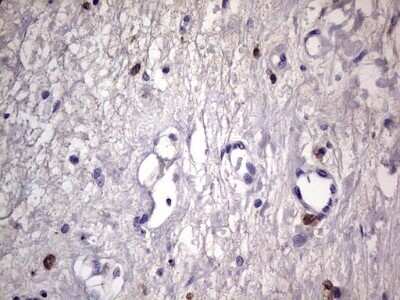 Immunohistochemistry: CD68/SR-D1 Antibody (OTI1E6) - Azide and BSA Free [NBP2-70381] - Analysis of Human bladder tissue.