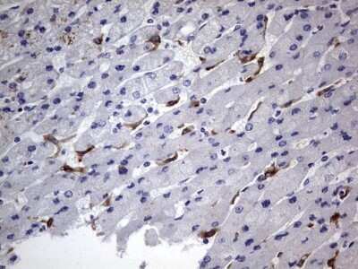 Immunohistochemistry: CD68/SR-D1 Antibody (OTI1E6) - Azide and BSA Free [NBP2-70381] - Analysis of Human liver tissue.