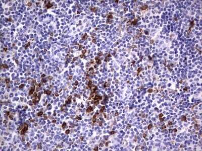 Immunohistochemistry: CD68/SR-D1 Antibody (OTI1E6) - Azide and BSA Free [NBP2-70381] - Analysis of Human tonsil tissue.
