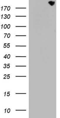 Western Blot: CD68/SR-D1 Antibody (OTI1E6) - Azide and BSA Free [NBP2-70381] - Analysis of HEK293T cells were transfected with the pCMV6-ENTRY control (Left lane) or pCMV6-ENTRY CD68.