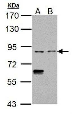 Western Blot: CD68/SR-D1 Antibody [NBP2-15814] - Sample (30 ug of whole cell lysate)  A: K562 B: THP-1 7.5% SDS PAGE diluted at 1:500