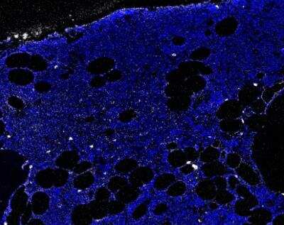 Imaging Mass Cytometry: CD69 Antibody (8B6) [NBP1-51607] - Human bone marrow FFPE tissue section. DNA stained in blue, CD69 stained in white. IMC image submitted by a verified customer review.