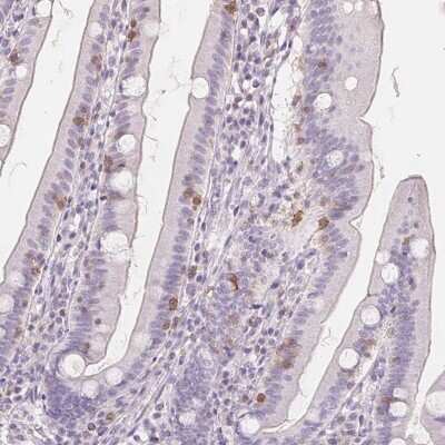 Immunohistochemistry-Paraffin: CD69 Antibody [NBP2-37926] - Staining of human duodenum shows moderate membranous positivity in a subset of lymphoid cells.