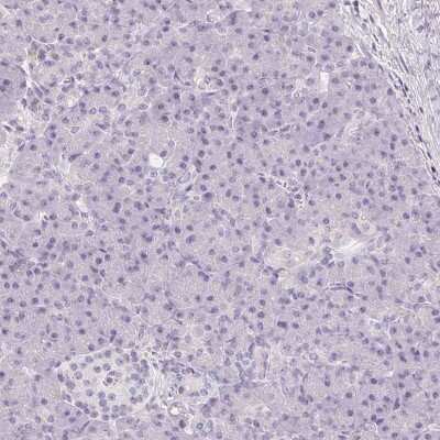 Immunohistochemistry-Paraffin: CD69 Antibody [NBP2-37926] - Staining of human pancreas shows no positivity in exocrine and endocrine glandular cells as expected.