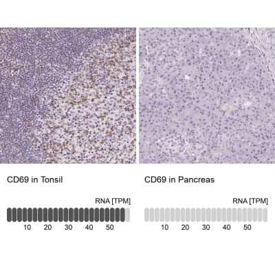 Immunohistochemistry-Paraffin: CD69 Antibody [NBP2-37926] - Staining in human tonsil and pancreas tissues . Corresponding CD69 RNA-seq data are presented for the same tissues.