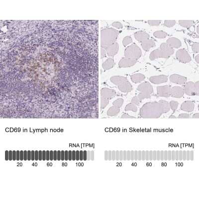 Immunohistochemistry-Paraffin: CD69 Antibody [NBP2-37926] - Analysis in human lymph node and skeletal muscle tissues using NBP2-37926 antibody. Corresponding CD69 RNA-seq data are presented for the same tissues.