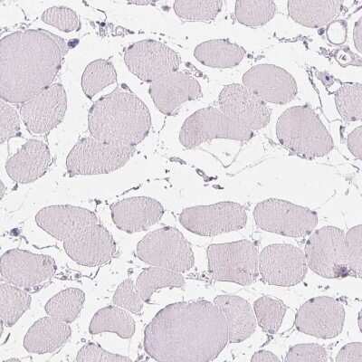 Immunohistochemistry-Paraffin: CD69 Antibody [NBP2-37926] - Staining of human skeletal muscle shows no membranous positivity in myocytes as expected.