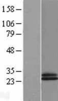 Western Blot: CD69 Overexpression Lysate (Adult Normal) [NBL1-08963] Left-Empty vector transfected control cell lysate (HEK293 cell lysate); Right -Over-expression Lysate for CD69.