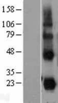 Western Blot: CD70 Overexpression Lysate (Adult Normal) [NBL1-08965] Left-Empty vector transfected control cell lysate (HEK293 cell lysate); Right -Over-expression Lysate for CD70.