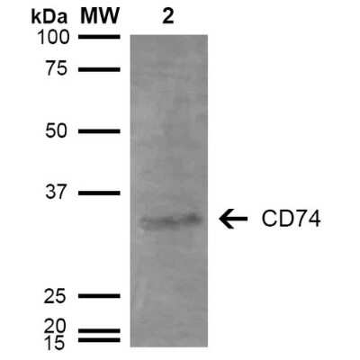 Western Blot: CD74 Antibody (3D7) [NBP2-59697] - Analysis of Human Lymphoblastoid cell line (Raji) showing detection of 33-35 kDa CD74 protein using Mouse Anti-CD74 Monoclonal Antibody, Clone 3D7 . Lane 1: Molecular Weight Ladder (MW). Lane 2: Raji cell lysate. Load: 15 ug. Block: 5% Skim Milk in TBST. Primary Antibody: Mouse Anti-CD74 Monoclonal Antibody  at 1:1000 for 2 hours at RT. Secondary Antibody: Goat Anti-Mouse IgG: HRP at 1:1000 for 60 min at RT. Color Development: ECL solution for 5 min in RT. Predicted/Observed Size: 33-35 kDa.