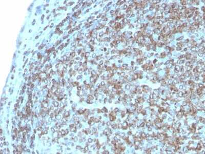 Immunohistochemistry-Paraffin: CD74 Antibody (CLIP/3127R) - Azide and BSA Free [NBP3-08927] - Formalin-fixed, paraffin-embedded human Tonsil stained with CD74 Recombinant Rabbit Monoclonal Antibody (CLIP/3127R).