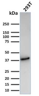 Western Blot: CD74 Antibody (CLIP/3127R) - Azide and BSA Free [NBP3-08927] - Western Blot Analysis of Human 293T cell lysate using CD74 Recombinant Rabbit Monoclonal Antibody (CLIP/3127R).