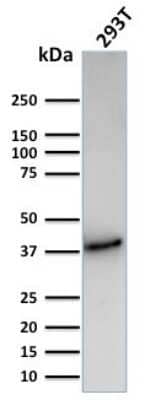 Western Blot: CD74 Antibody (CLIP/3127R) [NBP3-07225] - Western Blot Analysis of Human 293T cell lysate using CD74 Recombinant Rabbit Monoclonal Antibody (CLIP/3127R).