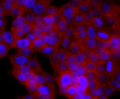 Immunocytochemistry/Immunofluorescence: CD74 Antibody (JF40-10) [NBP2-66762] - Staining CD74 in 293T cells (red). The nuclear counter stain is DAPI (blue). Cells were fixed in paraformaldehyde, permeabilised with 0.25% Triton X100/PBS.