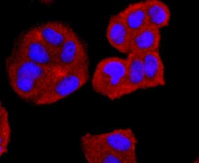 Immunocytochemistry/Immunofluorescence: CD74 Antibody (JF40-10) [NBP2-66762] - Staining CD74 in Hela cells (red). The nuclear counter stain is DAPI (blue). Cells were fixed in paraformaldehyde, permeabilised with 0.25% Triton X100/PBS.