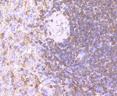 Immunohistochemistry-Paraffin: CD74 Antibody (JF40-10) [NBP2-66762] - Analysis of paraffin-embedded human spleen tissue using anti-CD74 antibody. Counter stained with hematoxylin.