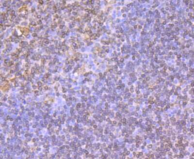 Immunohistochemistry-Paraffin: CD74 Antibody (JF40-10) [NBP2-66762] - Analysis of paraffin-embedded human tonsil tissue using anti-CD74 antibody. Counter stained with hematoxylin.