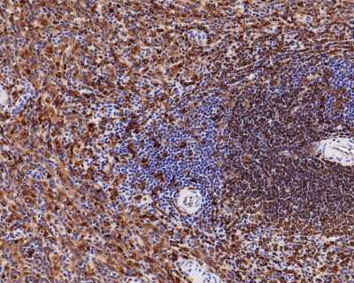 Immunohistochemistry-Paraffin: CD74 Antibody (JF40-10) [NBP2-66762] - Analysis of paraffin-embedded human spleen tissue with Rabbit anti-CD74 antibody washed with ddH2O and PBS, and then probed with the primary antibody  at 1/500 dilution for 1 hour at room temperature. The detection was performed using an HRP conjugated compact polymer system. DAB was used as the chromogen. Tissues were counterstained with hematoxylin and mounted with DPX.