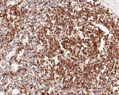 Immunohistochemistry-Paraffin: CD74 Antibody (JF40-10) [NBP2-66762] - Analysis of paraffin-embedded human lymph nodes tissue with Rabbit anti-CD74 antibody washed with ddH2O and PBS, and then probed with the primary antibody  at 1/500 dilution for 1 hour at room temperature. The detection was performed using an HRP conjugated compact polymer system. DAB was used as the chromogen. Tissues were counterstained with hematoxylin and mounted with DPX.