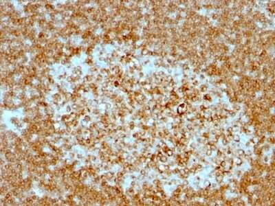 Immunohistochemistry-Paraffin: CD74 Antibody (LN-2 + CLIP/813) [NBP2-44992] - Human Tonsil stained with CD74 Monoclonal Antibody (LN-2 + CLIP/813).