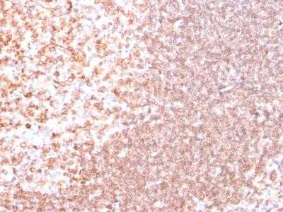 Immunohistochemistry-Paraffin: CD74 Antibody (SPM523) - Azide and BSA Free [NBP2-34778] - Formalin-paraffin human tonsil stained with CD74 Ab (SPM523).