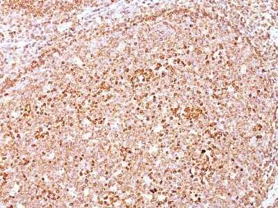 Immunohistochemistry-Paraffin: CD79A Antibody (HM47/A9) - Azide and BSA Free [NBP2-34637] - Formalin-fixed, paraffin-embedded human Tonsil stained with CD79A Antibody (HM47/A9).