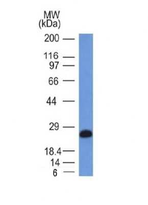 Western Blot: CD79A Antibody (IGA/1406) [NBP2-54370] - Ramos Cell Lysate using CD79a Monoclonal Antibody (IGA/1406).