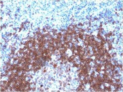 Immunohistochemistry-Paraffin: CD79A Antibody (IGA/1790R) - Azide and BSA Free [NBP3-11617] - Formalin-fixed, paraffin-embedded human Tonsil stained with CD79a Rabbit Recombinant Monoclonal Antibody (IGA/1790R).