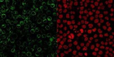 Immunocytochemistry/Immunofluorescence: CD79A Antibody (JCB117 + HM47/A9) - Azide and BSA Free [NBP2-34653] - Immunofluorescent staining of paraformaldehyde-fixed Raji cells. CD79A Antibody (JCB117 + HM47/A9) followed by goat anti-Mouse IgG-CF488 (Green). The nuclear counterstain is Red Dot (Red)