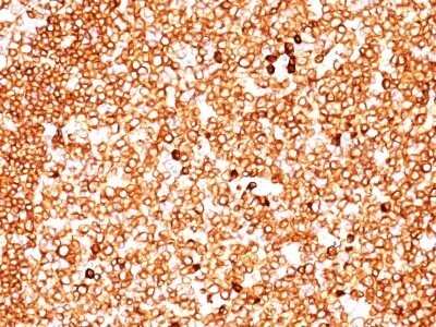 Immunohistochemistry-Paraffin: CD79A Antibody (JCB117 + HM47/A9) - Azide and BSA Free [NBP2-34653] - Formalin-fixed, paraffin-embedded human tonsil (20X) stained with CD79a MAb (JCB117 + HM47/A9).