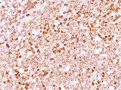 Immunohistochemistry-Paraffin: CD79A Antibody (JCB117 + HM47/A9) - Azide and BSA Free [NBP2-34653] - Formalin-fixed, paraffin-embedded human tonsil (10X) stained with CD79a MAb (JCB117 + HM47/A9).