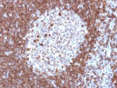 Immunohistochemistry-Paraffin: CD79A Antibody (JCB117) - Azide and BSA Free [NBP2-34652] - Formalin-fixed, paraffin-embedded human Tonsil stained with CD79A Antibody (JCB117).