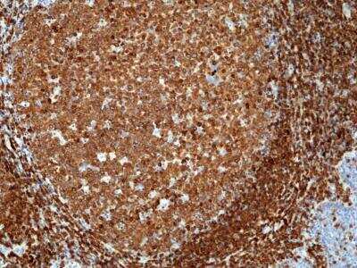 Immunohistochemistry-Paraffin: CD79A Antibody (RM297) [NBP2-61513] - Immunohistochemical staining of formalin fixed and paraffin embedded human tonsil tissue section using NBP2-61513 at a 1:200 dilution.