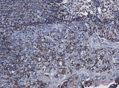Immunohistochemistry-Paraffin: CD79A Antibody (S02-7E3) [NBP3-19601] - Immunohistochemistry of CD79A in paraffin-embedded Human tonsil using NBP3-19601 at dilution 1/50