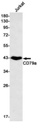 Western Blot: CD79A Antibody (S02-7E3) [NBP3-19601] - Western blot detection of CD79A in Jurkat cell lysates using NBP3-19601 (1:500 diluted). Predicted band size: 25kDa. Observed band size: 45-55kDa.