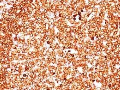 Immunohistochemistry-Paraffin: CD79A Antibody (SPM549) - IHC-Prediluted [NBP2-44737] - Formalin-fixed paraffin-embedded human tonsil stained with CD79a Monoclonal antibody (SPM549)