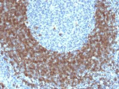 Immunohistochemistry-Paraffin: CD79B Antibody (IGB/1842) - Azide and BSA Free [NBP3-08219] - Formalin-fixed, paraffin-embedded human Tonsil stained with CD79B Mouse Monoclonal Antibody (IGB/1842).