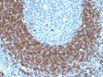 Immunohistochemistry-Paraffin: CD79B Antibody (IGB/1842) [NBP3-07226] - Formalin-fixed, paraffin-embedded human Tonsil stained with CD79B Mouse Monoclonal Antibody (IGB/1842).