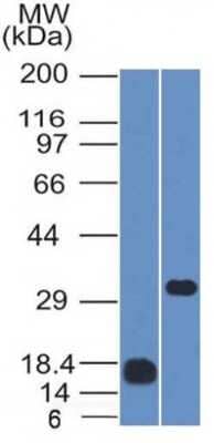 Western Blot: CD79B Antibody (IGB/1843) - Azide and BSA Free [NBP3-08596] - Western Blot Analysis (1) Human CD79B Recombinant fragment and (2) Raji cell lysate using CD79B Mouse Monoclonal Antibody (IGB/1843).