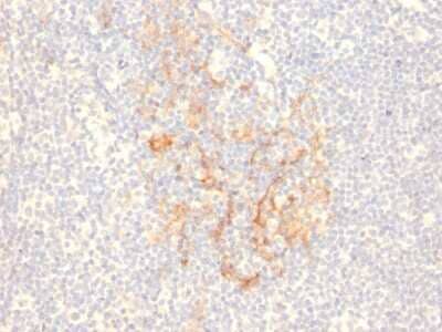 Immunohistochemistry-Paraffin: CD79B Antibody (IGB/2555) - Azide and BSA Free [NBP3-08603] - Formalin-fixed, paraffin-embedded human Tonsil stained with CD79B Mouse Monoclonal Antibody (IGB/2555).