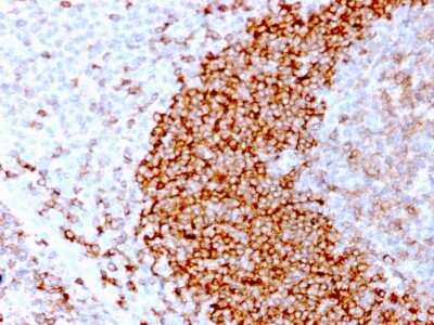 Immunohistochemistry-Paraffin: CD79B Antibody (IGB/3170R) [NBP3-07473] - Formalin-fixed, paraffin-embedded human Tonsil stained with CD79B Recombinant Rabbit Monoclonal Antibody (IGB/3170R).