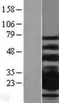 Western Blot CD79B Overexpression Lysate