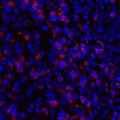 Immunocytochemistry/Immunofluorescence: CD8 Antibody (BLR044F) [NBP2-76422] - Detection of human CD8 alpha (red) in FFPE melanoma by IHC-IF. Antibody: Rabbit anti-CD8 alpha recombinant monoclonal [BLR044F] NBP2-76422. Secondary: DyLight® 594-conjugated goat anti-rabbit IgG.