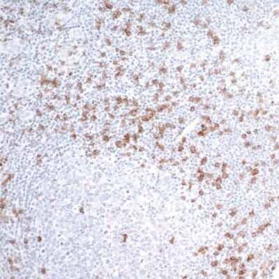 Immunohistochemistry-Paraffin: CD8 Antibody (BLR044F) [NBP2-76422] - Detection of human CD8 alpha in FFPE tonsil by IHC. Antibody: Rabbit anti-CD8 alpha recombinant monoclonal [BLR044F] (NBP2-76422). Secondary: HRP-conjugated goat anti-rabbit IgG. Substrate: DAB.