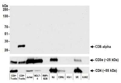 Western Blot: CD8 Antibody (BLR044F) [NBP2-76422] - Detection of human CD8 by WB of CD4+ T-cells, CD8+ T-cells, Jurkat, MOLT-4, RPMI-8226, MJ, C5/MJ, KG-1, SR, and K-562 cells. Antibody: Rabbit anti-CD8 alpha recombinant monoclonal [BLR044F] (NBP2-76422). Secondary: HRP-conjugated goat anti-rabbit IgG. Lower panel: Recombinant monoclonal antibodies to CD3e (NBP2-76424) and CD4 (NBP2-76423). A band appears at an observed molecular weight of approximately 32 kDa for the CD8 analysis.