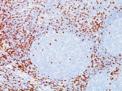 Immunohistochemistry-Paraffin: CD8 Antibody (C8/144B) - Azide and BSA Free [NBP2-34588] - Formalin-fixed, paraffin-embedded human Tonsil stained with CD8 Antibody (C8/144B).