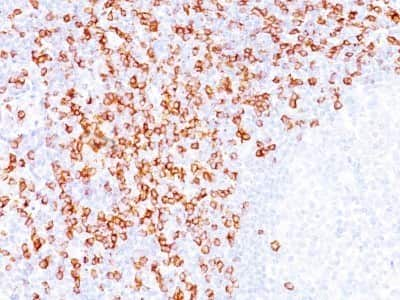 Immunohistochemistry-Paraffin: CD8 Antibody (C8/144B) - Azide and BSA Free [NBP2-34588] - Formalin-fixed, paraffin-embedded human Tonsil stained with CD8 Antibody (C8/144B).