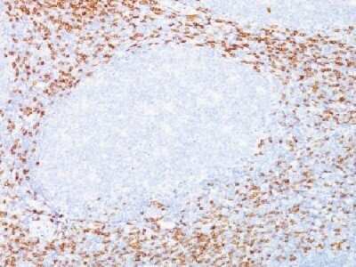 Immunohistochemistry-Paraffin: CD8 Antibody (C8/468 + C8/144B) - Azide and BSA Free [NBP2-34590] - Formalin-fixed paraffin-embedded human tonsil stained with CD8 Monoclonal Antibody (C8/468+C8/144)